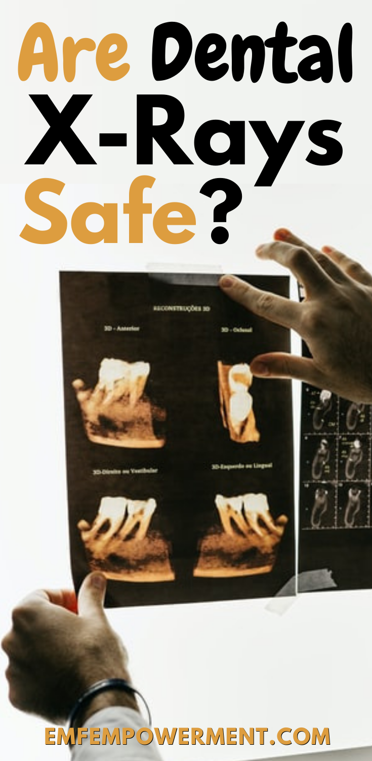 Are Dental X-Rays Safe? All About X-Ray Radiation